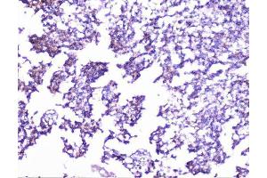 IHC analysis of cortactin using anti-cortactin antibody (ABIN6719306). (Cortactin 抗体  (AA 1-105))