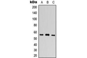 Western blot analysis of PLXDC1 expression in HEK293T (A), Raw264. (PLXDC1 抗体  (Center))