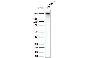 Western Blot Analysis of Human PANC-1 cell lysates using Spectrin Beta 3 Rabbit Monoclonal Antibody (SPTBN2/2979R). (Recombinant Spectrin, Beta, Non-erythrocytic 2 (SPTBN2) (AA 356-475) 抗体)