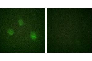 Forskolin + -Immunofluorescence analysis of HeLa cells, treated with Forskolin (40nM, 30mins), using AurB (Ab-12) antibody. (Aurora Kinase B 抗体)