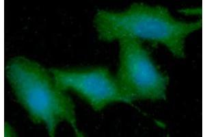 ICC/IF analysis of KRT5 in A549 cells line, stained with DAPI (Blue) for nucleus staining and monoclonal anti-human KRT5 antibody (1:100) with goat anti-mouse IgG-Alexa fluor 488 conjugate (Green). (Cytokeratin 5 抗体  (AA 1-590))
