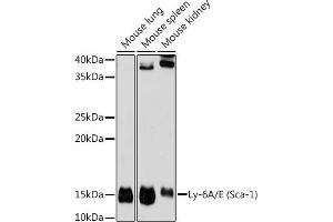Western blot analysis of extracts of various cell lines, using Ly-6A/E (Sca-1) antibody (ABIN7268313) at 1:1000 dilution. (Sca-1/Ly-6A/E 抗体)