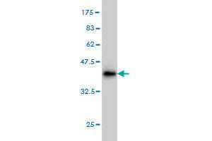 Western Blot detection against Immunogen (36. (DAZ1 抗体  (AA 21-120))