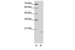 Image no. 1 for anti-Nucleolar Protein 6 (NOL6) (C-Term) antibody (ABIN203026) (Nucleolar Protein 6 抗体  (C-Term))