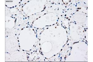 Immunohistochemical staining of paraffin-embedded lung tissue using anti-MAP2K4mouse monoclonal antibody. (MAP2K4 抗体)