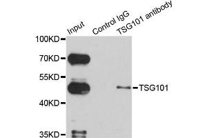 Immunoprecipitation analysis of 150ug extracts of HeLa cells using 3ug TSG101 antibody. (TSG101 抗体)