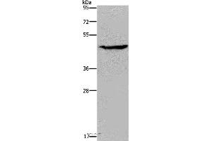 Western blot analysis of K562 cell, using ACP6 Polyclonal Antibody at dilution of 1:200