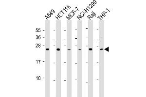 All lanes : Anti-TPD52 Antibody (C-Term) at 1:2000 dilution Lane 1: A549 whole cell lysate Lane 2: HC whole cell lysate Lane 3: MCF-7 whole cell lysate Lane 4: NCI- whole cell lysate Lane 5: Raji whole cell lysate Lane 6: THP-1 whole cell lysate Lysates/proteins at 20 μg per lane. (TPD52 抗体  (AA 193-223))