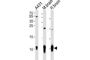 Western blot analysis of lysates from A431 cell line, mouse brain, rat brain tissue (from left to right), using S100B Antibody (ABIN651265 and ABIN2840160). (S100B 抗体)