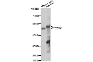 Western blot analysis of extracts of various cell lines, using WNT2 Antibody (ABIN6292350) at 1:1000 dilution. (WNT2 抗体)