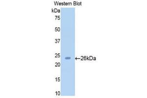 Western Blotting (WB) image for anti-Sirtuin 4 (SIRT4) (AA 60-255) antibody (ABIN1176392) (SIRT4 抗体  (AA 60-255))