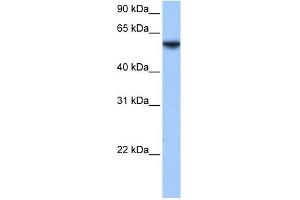 ISYNA1 antibody used at 1 ug/ml to detect target protein. (ISYNA1 抗体  (N-Term))