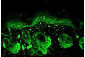 Mn SOD Immunofluorescence. (SOD2 抗体)