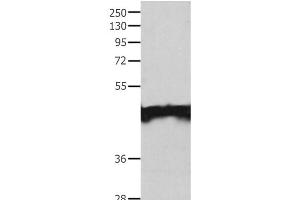 Western Blot analysis of Jurkat cell using MAT1A Polyclonal Antibody at dilution of 1:200 (MAT1A 抗体)