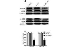 Western Blotting (WB) image for anti-Eukaryotic Translation Initiation Factor 4E Binding Protein 1 (EIF4EBP1) (C-Term) antibody (ABIN3021844)