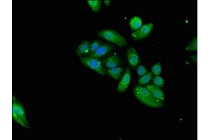 Immunofluorescence (IF) image for anti-Killer Cell Lectin-Like Receptor Subfamily D, Member 1 (KLRD1) (AA 42-168) antibody (ABIN7161085)
