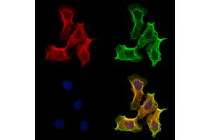 ABIN6264780 and ABIN6273155 staining Hela cells by IF/ICC. (RND3 抗体  (Internal Region))