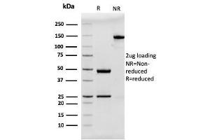 SDS-PAGE Analysis Purified MUC2 Recombinant Mouse Monoclonal Antibody (rMLP/842). (Recombinant MUC2 抗体)