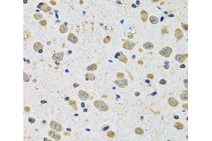 Immunohistochemistry of paraffin-embedded Rat brain using EPHA2 Polyclonal Antibody at dilution of 1:100 (40x lens). (EPH Receptor A2 抗体)