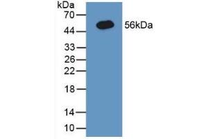 Detection of Recombinant CNX, Human using Polyclonal Antibody to Calnexin (CNX) (Calnexin 抗体  (AA 239-461))