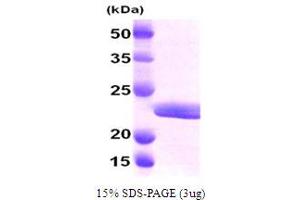 MYL2 Protein (AA 1-166) (His tag)
