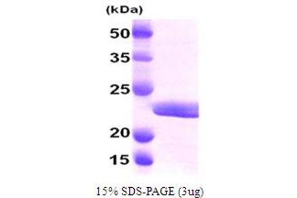 MYL2 Protein (AA 1-166) (His tag)