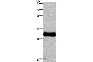 Western blot analysis of Mouse skeletal muscle tissue, using FHL3 Polyclonal Antibody at dilution of 1:1600 (FHL3 抗体)