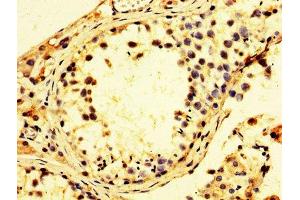 Immunohistochemistry of paraffin-embedded human testis tissue using ABIN7142230 at dilution of 1:100 (PSMC3 抗体  (Regulatory Subunit 6A))