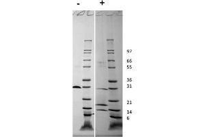 SDS-PAGE of Human Platelet Derived Growth Factor-AB Recombinant Protein SDS-PAGE of Human Platelet Derived Growth Factor-AB Recombinant Protein. (PDGF-AB Heterodimer 蛋白)