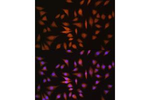 Immunofluorescence analysis of L929 cells using NRBF2 antibody  at dilution of 1:100. (NRBF2 抗体  (AA 10-220))