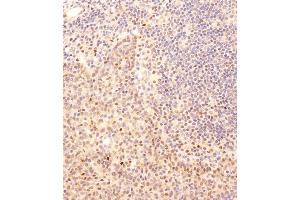 Immunohistochemical analysis of B on paraffin-embedded human tonsil tissue was performed on the Leica®BOND RXm. (SMAD2 抗体  (AA 201-230))