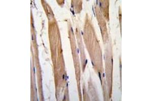 Formalin-fixed and paraffin-embedded human skeletal muscle tissue reacted with VINC antibody (N-term) , which was peroxidase-conjugated to the secondary antibody, followed by DAB staining. (Vinculin 抗体  (N-Term))