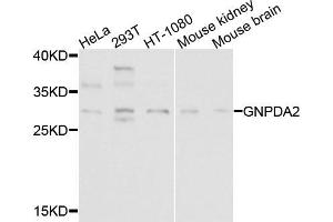 Western blot analysis of extracts of various cells, using GNPDA2 antibody. (GNPDA2 抗体)