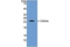 Detection of Recombinant SOD2, Mouse using Polyclonal Antibody to Superoxide Dismutase 2, Mitochondrial (SOD2) (SOD2 抗体  (AA 25-222))