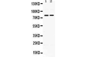 Western blot analysis of AMFR expression in rat thymus extract ( Lane 1) and HELA whole cell lysates ( Lane 2). (AMFR 抗体  (AA 553-643))