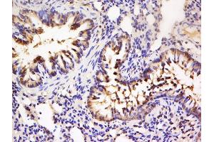 Paraformaldehyde-fixed, paraffin embedded rat lung, Antigen retrieval by boiling in sodium citrate buffer (pH6) for 15min, Block endogenous peroxidase by 3% hydrogen peroxide for 30 minutes, Blocking buffer (normal goat serum) at 37°C for 20min, Antibody incubation with Rabbit Anti-MSK1 (Ser360) Polyclonal Antibody, Unconjugated  at 1:200 overnight at 4°C, followed by a conjugated secondary for 90 minutes and DAB staining. (MSK1 抗体  (pSer360))