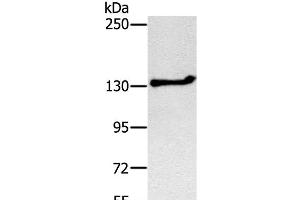 Western Blot analysis of Jurkat cell using NEMF Polyclonal Antibody at dilution of 1:200