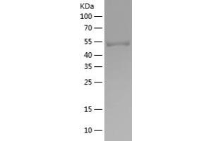 Western Blotting (WB) image for Synaptotagmin I (SYT1) (AA 1-220) protein (His-IF2DI Tag) (ABIN7125273) (SYT1 Protein (AA 1-220) (His-IF2DI Tag))
