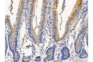 NLRP3 Mouse monoclonal Antibody at 1/100 staining rat colorectal tissue by IHC-P.