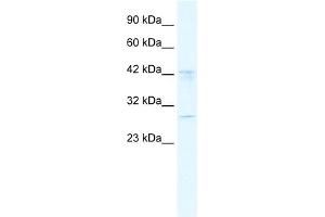 WB Suggested Anti-BRD9 Antibody Titration:  2. (BRD9 抗体  (N-Term))
