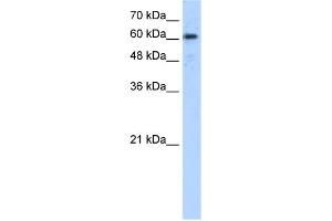 WB Suggested Anti-ADAM30 Antibody Titration:  5. (ADAM30 抗体  (N-Term))