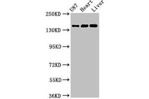Western Blot Positive WB detected in: U87 whole cell lysate, Rat heart tissue, Mouse liver tissue All lanes: GRIN2A antibody at 3. (NMDAR2A 抗体  (AA 501-750))