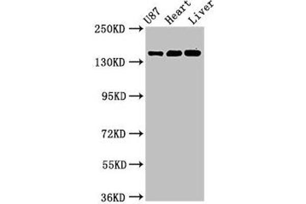 NMDAR2A Antikörper  (AA 501-750)