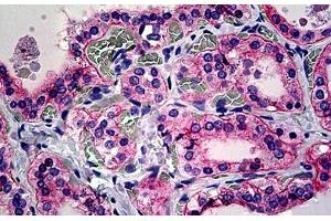 Human Thyroid: Formalin-Fixed, Paraffin-Embedded (FFPE) (CD51 抗体  (Cleaved-Lys889))