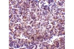 Immunohistochemistry (IHC) image for anti-CD180 Molecule (CD180) (N-Term) antibody (ABIN1031545) (CD180 抗体  (N-Term))