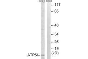 Western blot analysis of extracts from COLO cells, using ATP5I Antibody. (ATP5I 抗体  (AA 20-69))