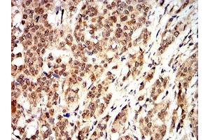 Immunohistochemistry (IHC) image for anti-Cyclin D1 (CCND1) (AA 167-295) antibody (ABIN5862106) (Cyclin D1 抗体  (AA 167-295))