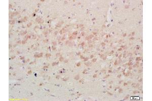 Formalin-fixed and paraffin embedded rat brain tissue labeled Anti-IGFBP3 Polyclonal Antibody, Unconjugated (ABIN686497) at 1:200, followed by conjugation to the secondary antibody and DAB staining