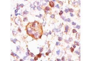 IHC testing of Hodgkin's lymphoma stained with Bcl-X antibody (BX006). (BCL2L1 抗体)