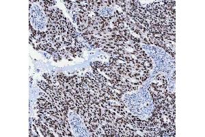 IHC analysis of FEN1 using anti-FEN1 antibody (ABIN7601617). (FEN1 抗体  (AA 4-300))